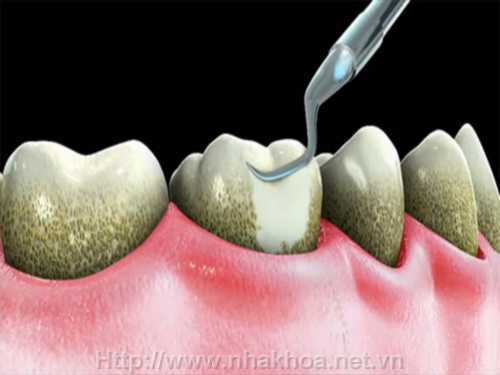 Vụ bảo mẫu hành hạ trẻ em: Thấm những nỗi đau